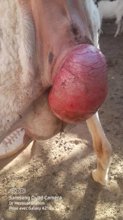 مثبت خروج الرحم